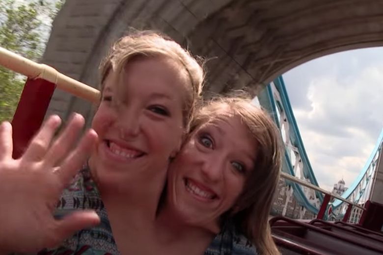 Siamese-tweeling-nieuws