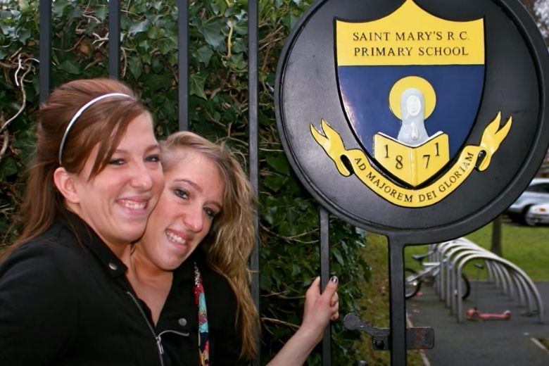 Siamese-tweeling-nieuws