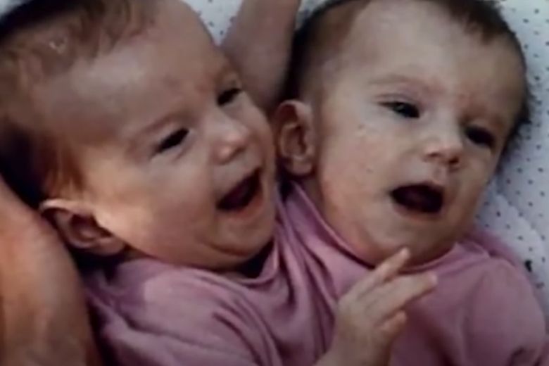Siamese-tweeling-nieuws