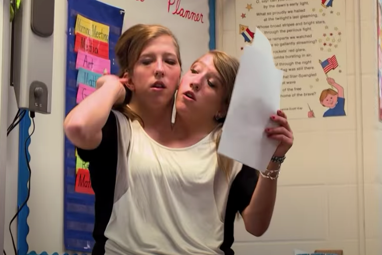 Siamese-tweeling-nieuws (2)