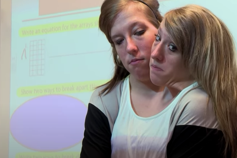 Siamese-tweeling-nieuws